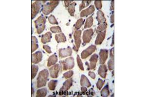 LRP12 Antibody immunohistochemistry analysis in formalin fixed and paraffin embedded human skeletal muscle followed by peroxidase conjugation of the secondary antibody and DAB staining. (LRP12 Antikörper  (C-Term))