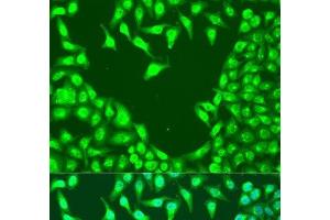 Immunofluorescence analysis of U2OS cells using MAP2K4 Polyclonal Antibody at dilution of 1:100. (MAP2K4 Antikörper)