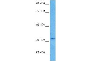 Host:  Rabbit  Target Name:  CBR3  Sample Tissue:  Human U937 Whole Cell lysates  Antibody Dilution:  1ug/ml (CBR3 Antikörper  (C-Term))