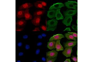 ABIN7094246 and ABIN7098293 staining Hela cells by IF/ICC. (GABPB1 Antikörper  (Internal Region))