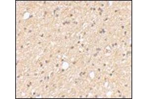 Immunohistochemical staining of human brain tissue using AP30499PU-N at 2. (LGI2 Antikörper  (Center))