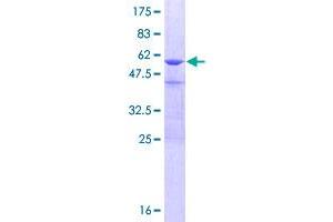 CRYBB3 Protein (AA 1-211) (GST tag)