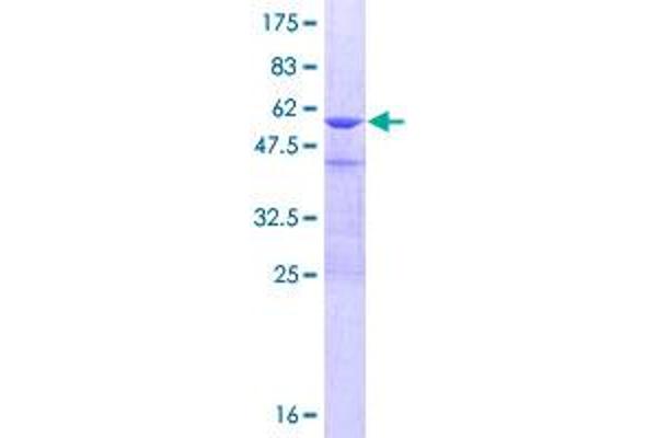 CRYBB3 Protein (AA 1-211) (GST tag)