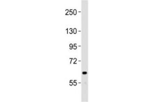 Western blot testing of NOTCH4 antibody at 1:2000 dilution + human liver lysate (NOTCH4 Antikörper  (C-Term))