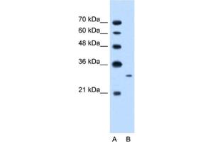 Western Blotting (WB) image for anti-MAP3K7 C-Terminal Like (MAP3K7CL) antibody (ABIN2462602) (MAP3K7CL Antikörper)
