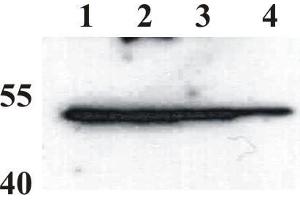 Western Blot testing of anti-BPV E2 monoclonal antibody (1E2). (Bovine Papilloma Virus 1 E2 (BPV-1 E2) (AA 208-218) Antikörper)