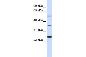 WB Suggested Anti-ZNF488 Antibody Titration:  0. (ZNF488 Antikörper  (Middle Region))