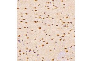 Immunohistochemistry of paraffin embedded mouse brain using ALS2CR13 (ABIN7073909) at dilution of 1:1800 (400x lens) (FAM117B Antikörper)