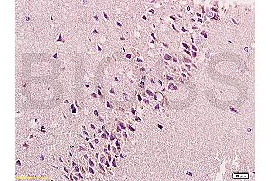 Formalin-fixed and paraffin embedded: rat brain tissue labeled with Anti-bFGF Polyclonal Antibody, Unconjugated (ABIN726425) at 1:200, followed by conjugation to the secondary antibody and DAB staining (FGF2 Antikörper  (AA 143-250))
