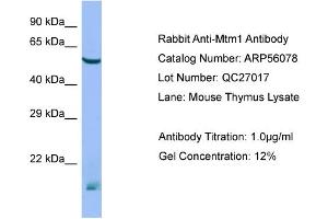 Western Blotting (WB) image for anti-Myotubularin 1 (MTM1) (N-Term) antibody (ABIN2786502)