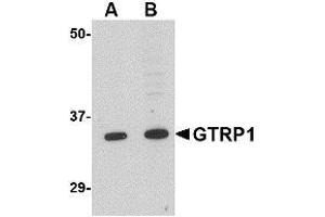Western blot analysis of GRTP1 in K562 cell lysate with AP30387PU-N GRTP1 antibody at (A) 1 and (B) 2 μg/ml. (GRTP1 Antikörper  (N-Term))