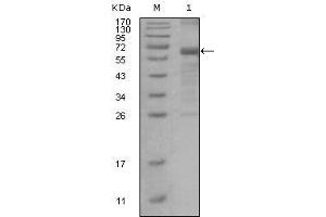 Western blot analysis using MSH6 mouse mAb against truncated MSH6 recombinant protein.
