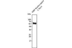 Western Blotting (WB) image for anti-SARS-CoV-2 Nucleocapsid (SARS-CoV-2 N) (C-Term) antibody (ABIN7272991) (SARS-CoV-2 Nucleocapsid Antikörper  (C-Term))