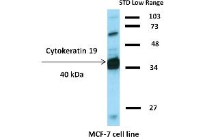 Western blotting analysis of human cytokeratin 19 using mouse monoclonal antibody BA-17 on lysates of HT-29 cell line and MOLT-4 cell line (cytokeratin non-expressing cell line, negative control) under non-reducing and reducing conditions.