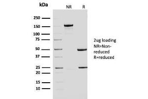 SDS-PAGE Analysis Purified ERCC1 Mouse Monoclonal Antibody (ERCC1/2683). (ERCC1 Antikörper  (AA 191-281))