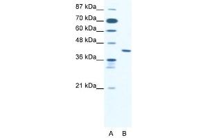 ZNF621 antibody (20R-1078) used at 0. (ZNF621 Antikörper  (Middle Region))