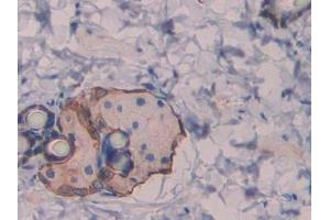 DAB staining on IHC-P; Samples: Rat Skin Tissue (Reelin Antikörper  (AA 2400-2610))