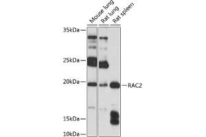 Western blot analysis of extracts of various cell lines, using R Polyclonal Antibody (ABIN3021523, ABIN3021524, ABIN3021525 and ABIN6215193) at 1:1000 dilution. (RAC2 Antikörper  (AA 1-192))