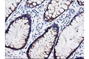 Immunohistochemical staining of paraffin-embedded Human colon tissue using anti-LXN mouse monoclonal antibody. (Latexin Antikörper)