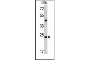 Image no. 1 for anti-Dicer 1, Ribonuclease Type III (DICER1) (AA 1010-1040), (Middle Region) antibody (ABIN357311) (DICER1 Antikörper  (Middle Region))