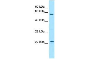 WB Suggested Anti-FGF17 Antibody Titration: 1. (FGF17 Antikörper  (Middle Region))