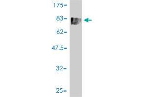 Western Blot detection against Immunogen (79. (SLC18A1 Antikörper  (AA 1-493))