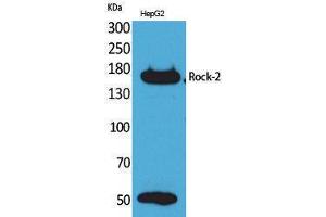 Western Blotting (WB) image for anti-rho-Associated, Coiled-Coil Containing Protein Kinase 2 (ROCK2) (Internal Region) antibody (ABIN3187730) (ROCK2 Antikörper  (Internal Region))