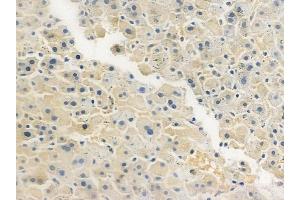 anti-Caspase Recruitment Domain Family, Member 11 (CARD11) (Internal Region) antibody