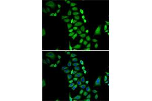 Immunofluorescence analysis of A-549 cells using GLO1 antibody (ABIN3015726, ABIN3015727, ABIN3015728 and ABIN6219077). (GLO1 Antikörper  (AA 1-184))