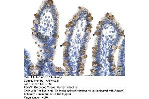 Rabbit Anti-EXOSC3 Antibody  Paraffin Embedded Tissue: Human Intestine Cellular Data: Epithelial cells of intestinal villas Antibody Concentration: 4. (EXOSC3 Antikörper  (Middle Region))