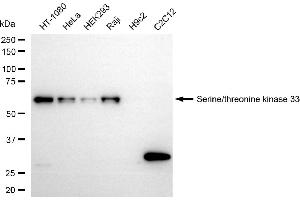 Western blotting analysis using serine/threonine kinase 33 antibody (ABIN7800313). (Rekombinanter STK33 Antikörper)