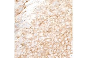 Immunohistochemistry (IHC) image for anti-Y Box Binding Protein 1 (YBX1) (AA 224-274) antibody (ABIN7453588) (YBX1 Antikörper  (AA 224-274))