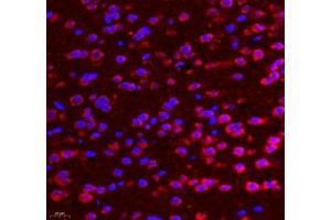 Immunofluorescence (Paraffin-embedded Sections) (IF (p)) image for anti-Adhesion Molecule with Ig-Like Domain 2 (AMIGO2) antibody (ABIN7072966)