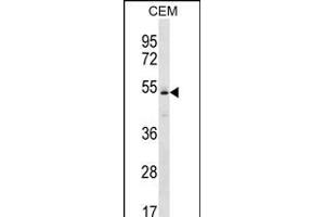 KCNJ4 Antibody (N-term) (ABIN656232 and ABIN2845547) western blot analysis in CEM cell line lysates (35 μg/lane). (KCNJ4 Antikörper  (N-Term))