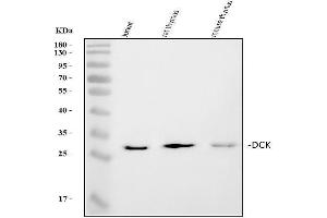 Western blot analysis of DCK using anti-DCK antibody (ABIN5693016). (DCK Antikörper  (AA 17-260))