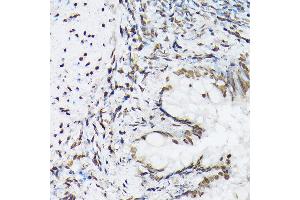 Immunohistochemistry of paraffin-embedded rat lung using Histone H1t Rabbit pAb (ABIN7267716) at dilution of 1:100 (40x lens). (Histone H1 Antikörper  (AA 150-207))