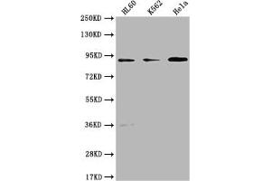 Western Blot Positive WB detected in: HL60 whole cell lysate, K562 whole cell lysate, Hela whole cell lysate All lanes: RPTN antibody at 1:1000 Secondary Goat polyclonal to rabbit IgG at 1/50000 dilution Predicted band size: 91 kDa Observed band size: 91 kDa (Repetin Antikörper  (AA 86-103))