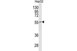 Western Blotting (WB) image for anti-Nucleoporin 62kDa (NUP62) antibody (ABIN3003247) (NUP62 Antikörper)