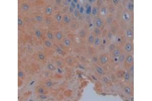 IHC-P analysis of Human Tissue, with DAB staining. (TRAF6 Antikörper  (AA 153-423))