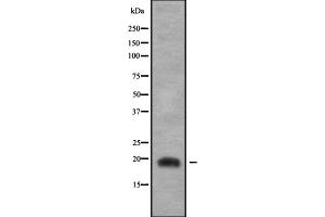 Western blot analysis of JDP2 using COLO205 whole cell lysates (JDP2 Antikörper  (C-Term))