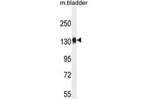 TDRD7 Antibody (C-term) western blot analysis in mouse bladder tissue lysates (35 µg/lane). (TDRD7 Antikörper  (C-Term))