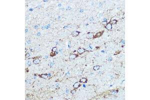 Immunohistochemistry of paraffin-embedded rat brain using NMD Rabbit pAb (ABIN6133733, ABIN6141400, ABIN6141403 and ABIN6223602) at dilution of 100 (40x lens). (GRIN1/NMDAR1 Antikörper  (AA 600-700))