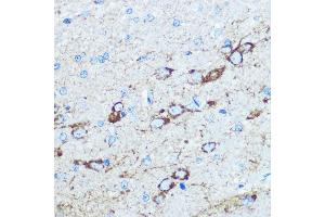 Immunohistochemistry of paraffin-embedded rat brain using NMD Rabbit pAb (ABIN6133733, ABIN6141400, ABIN6141403 and ABIN6223602) at dilution of 100 (40x lens).