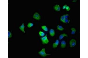 Immunofluorescent analysis of MCF-7 cells using ABIN7170144 at dilution of 1:100 and Alexa Fluor 488-congugated AffiniPure Goat Anti-Rabbit IgG(H+L) (SLC22A2 Antikörper  (AA 48-135))