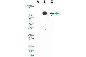 Western blot analysis of TLR3 in lysates from untransfected 293 cells (lane A), 293 cells transfected with human TLR3 cDNA (lane B), and 20 ug/lane human intestine tissue lysate (lane C). (TLR3 Antikörper)