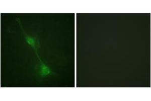 Immunofluorescence analysis of NIH-3T3 cells, using Ataxin 1 (Ab-776) Antibody. (Ataxin 1 Antikörper  (AA 742-791))
