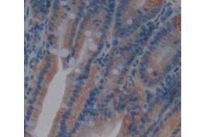Immunohistochemistry (IHC) image for anti-Tumor Necrosis Factor (Ligand) Superfamily, Member 13 (TNFSF13) (AA 96-240) antibody (ABIN1860805)
