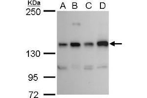 WB Image RET antibody detects RET protein by western blot analysis.
