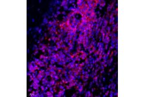 Immunofluorescence of paraffin embedded human lymph node using Thymosin (ABIN7075306) at dilution of 1:1500 (400x lens) (PTMA Antikörper)
