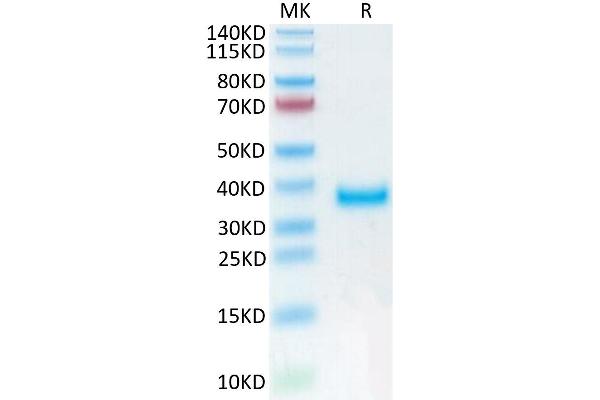 Prolactin Receptor Protein (PRLR) (AA 25-234) (His tag)